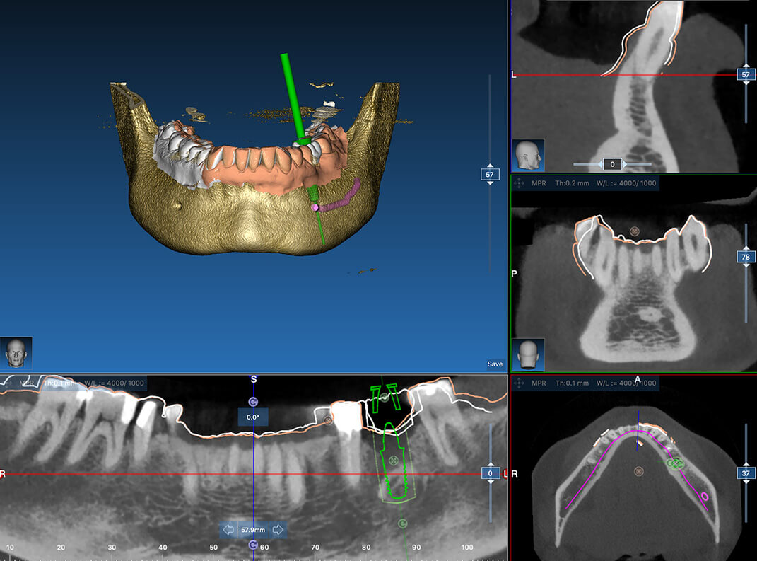 Radiologia digitale​